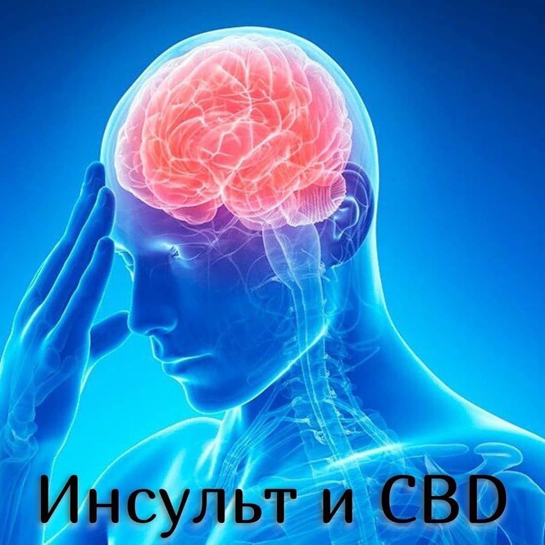 ИНСУЛЬТ И CBD купить cbd масло в России в Москве